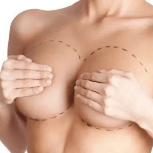 Possible Risks of Breast Enlargement: What to Expect